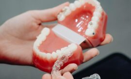 Le prix d’Invisalign au Maroc : combien coûte ce traitement orthodontique discret ?
