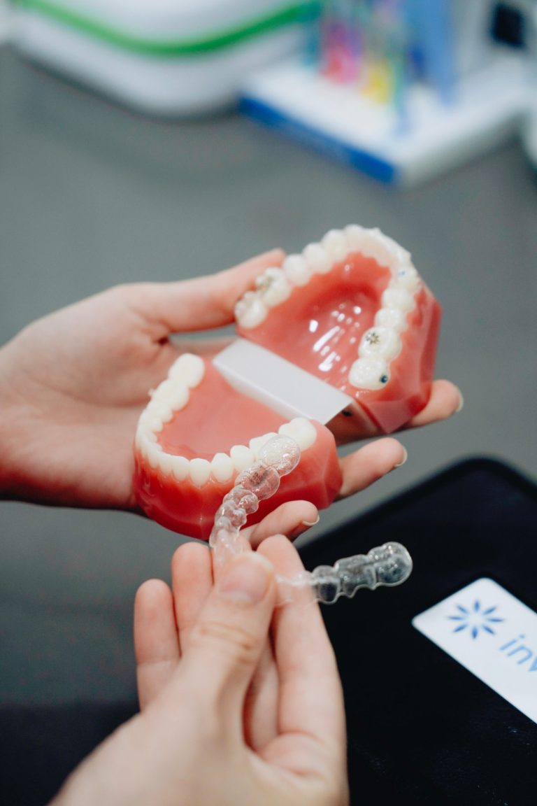 Lire la suite à propos de l’article Invisalign Prix Maroc: Le Guide Complet Pour Trouver Le Meilleur Tarif