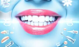 Les implants dentaires : Un guide essentiel