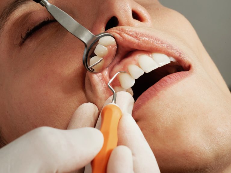 Lire la suite à propos de l’article Votre guide pour la gingivectomie au Maroc: Prix, techniques et cabinets fiables.
