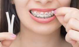 Comment utiliser la cire orthodontique au Maroc