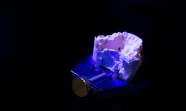 Impression 3D en Dentisterie : Un Pas de Géant Vers le Futur des Soins Dentaires