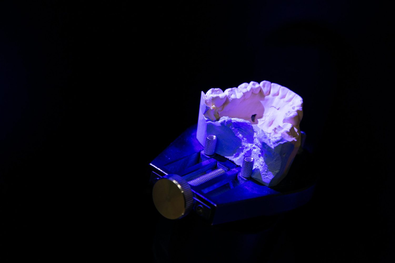Imprimante 3D créant une prothèse dentaire, symbole de la révolution numérique dans l'industrie dentaire