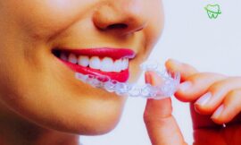 Prix d’Invisalign au Maroc : Guide complet