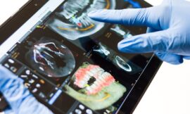 L’implant dentaire le jour même vous convient-il ?