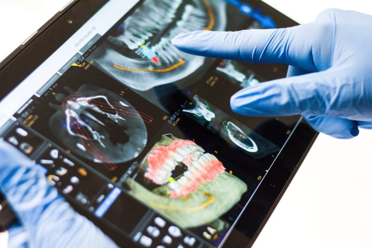 Lire la suite à propos de l’article L’implant dentaire le jour même vous convient-il ?