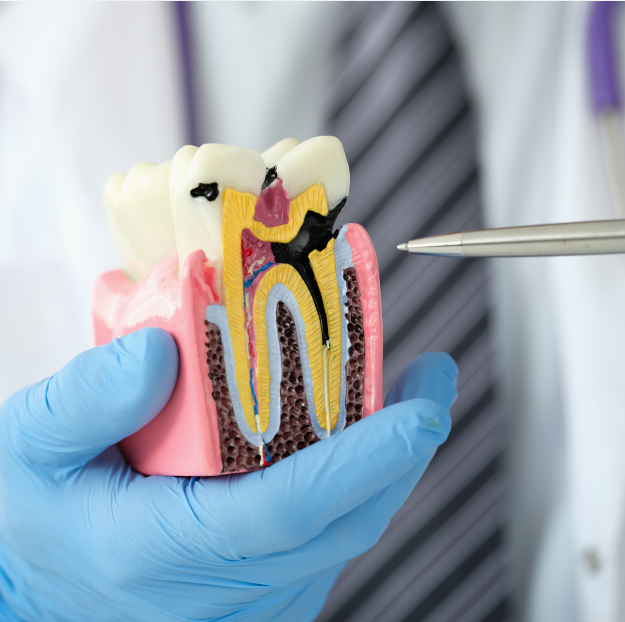 Lire la suite à propos de l’article Attention : Les Caries Dentaires Peuvent Être Mortelles
