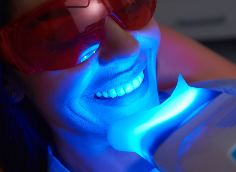Une patiente subissant un traitement de blanchiment dentaire à l'aide d'une lampe LED bleue, avec des lunettes de protection pour les yeux.