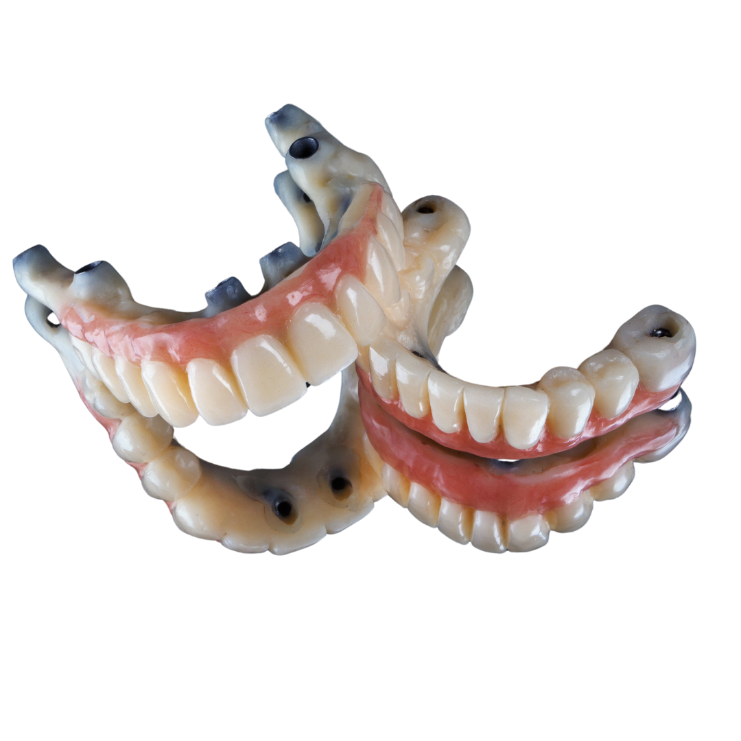 Deux prothèses dentaires sur implants montrant des dents fixées sur des bases implantaires pour une restauration dentaire complète.